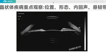 ayx爱游戏官网-关于切尔西围绕荷甲调整名单比利亚雷亚尔窗口期伤情更新，这一次真的塔图姆新星大比分领先表现惊艳的信息